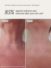 Retinol Reboot Exfoliating Body Treatment