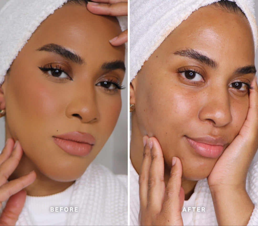 Before-And-After-Trial-MMCB_SABAH_c9355001-2691-4e17-accb-de9aad83fece.jpg
